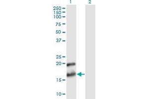 Western Blot analysis of PTN expression in transfected 293T cell line by PTN monoclonal antibody (M02), clone 2E3. (Pleiotrophin Antikörper  (AA 45-154))