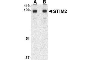 Western Blotting (WB) image for anti-Stromal Interaction Molecule 2 (Stim2) (C-Term) antibody (ABIN1030707) (Stim2 Antikörper  (C-Term))