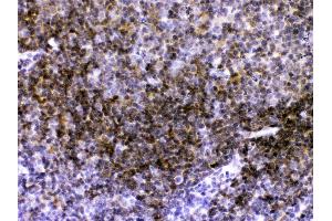 CD40/TNFRSF5 was detected in paraffin-embedded sections of mouse lymphaden tissues using rabbit anti- CD40/TNFRSF5 Antigen Affinity purified polyclonal antibody (Catalog # ) at 1 ? (CD40 Antikörper  (AA 20-193))