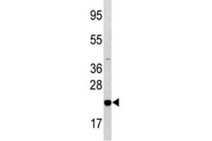 Western blot analysis of Bad antibody and HL-60 lysate. (BAD Antikörper  (AA 53-81))