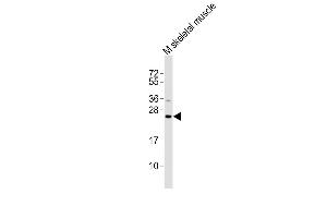 Cardiotrophin 1 Antikörper