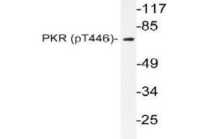 Western blot (WB) analyzes of p-PKR (pThr446) antibody in extracts from NIH-3T3 IFN cells. (EIF2AK2 Antikörper  (pThr446))
