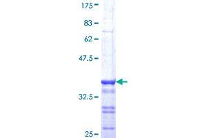 BRCA1 Protein (AA 1581-1670) (GST tag)