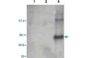 Western blot using Cyp1a2 monoclonal antibody, clone, 3B8C1  on recombinant CYP1B1 (lane 1), CYP1A1 (lane 2) and Cyp1a2 (lane 3) (0. (CYP1A2 Antikörper)