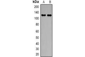 Western blot analysis of NBC1 expression in PC3 (A), A549 (B) whole cell lysates. (SLC4A4 Antikörper)