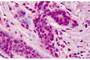 anti-Docking Protein 1, 62kDa (Downstream of tyrosine Kinase 1) (DOK1) (C-Term) antibody