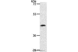 Western blot analysis of 231 cell, using PLAT Polyclonal Antibody at dilution of 1:450 (PLAT Antikörper)