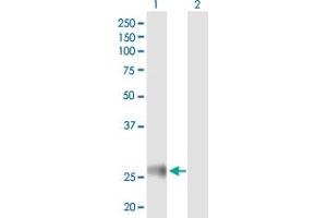 Western Blotting (WB) image for anti-Major Histocompatibility Complex, Class II, DR beta 4 (HLA-DRB4) (AA 1-266) antibody (ABIN516516)