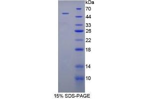 SDS-PAGE (SDS) image for Peroxiredoxin 1 (PRDX1) (AA 1-199) protein (His tag,GST tag) (ABIN1821707)