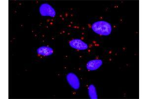 Proximity Ligation Assay (PLA) image for anti-Mechanistic Target of Rapamycin (serine/threonine Kinase) (mTOR) (AA 1521-1620) antibody (ABIN560949)