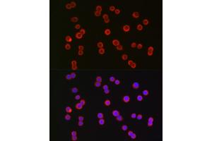 Immunofluorescence (IF) image for anti-Cystic Fibrosis Transmembrane Conductance Regulator (ATP-Binding Cassette Sub-Family C, Member 7) (CFTR) (AA 1161-1480) antibody (ABIN6138469)