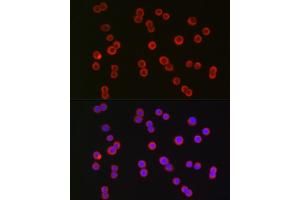 Immunofluorescence analysis of HT-29 cells using CFTR Rabbit pAb (ABIN6129855, ABIN6138469, ABIN6138470 and ABIN6224429) at dilution of 1:150 (40x lens). (CFTR Antikörper  (AA 1161-1480))