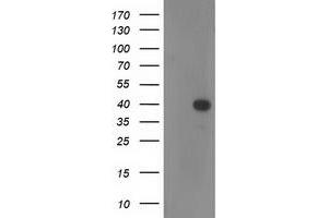 Western Blotting (WB) image for anti-Reticulon 4 Interacting Protein 1 (RTN4IP1) antibody (ABIN1500772) (RTN4IP1 Antikörper)