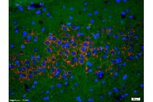 Formalin-fixed and paraffin-embedded rat brain labeled with Anti-Phospho-NMDAR1(Ser890) Polyclonal Antibody, Unconjugated (ABIN744278) 1:200, overnight at 4°C, The secondary antibody was Goat Anti-Rabbit IgG, Cy3 conjugated used at 1:200 dilution for 40 minutes at 37°C. (GRIN1/NMDAR1 Antikörper  (pSer890))
