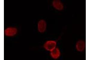 ABIN6274197 staining HuvEc cells by IF/ICC. (CDK11 Antikörper  (N-Term))