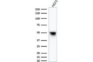 Western Blot Analysis of HEP2 cell lysate using Vimentin Mouse Monoclonal Antibody (VM1170). (Vimentin Antikörper)