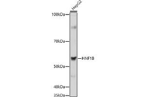 Western blot analysis of extracts of HepG2 cells, using HNF1B antibody (ABIN3017358, ABIN3017359, ABIN3017360, ABIN1680315 and ABIN1680316) at 1:1000 dilution. (HNF1B Antikörper  (AA 100-200))