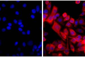 Human pancreatic carcinoma cell line MIA PaCa-2 was stained with Mouse Anti-Cytokeratin 18-UNLB and DAPI.