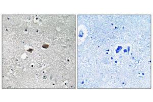 Immunohistochemistry (IHC) image for anti-Tigger Transposable Element Derived 3 (TIGD3) (C-Term) antibody (ABIN1852280) (TIGD3 Antikörper  (C-Term))