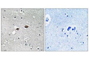 Immunohistochemistry (IHC) image for anti-Tigger Transposable Element Derived 3 (TIGD3) (C-Term) antibody (ABIN1852280) (TIGD3 Antikörper  (C-Term))