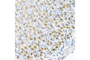 Immunohistochemistry of paraffin-embedded mouse stomach using FECH antibody at dilution of 1:100 (x40 lens). (FECH Antikörper)