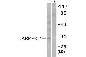 Western Blotting (WB) image for anti-Protein Phosphatase 1, Regulatory (Inhibitor) Subunit 1B (PPP1R1B) (Thr75) antibody (ABIN1847886) (DARPP32 Antikörper  (Thr75))