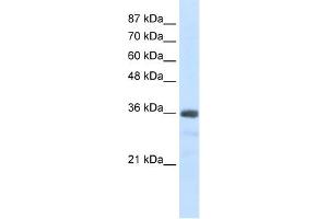 U1SNRNPBP antibody used at 2. (SNRNP35 Antikörper  (N-Term))
