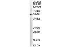 Western Blotting (WB) image for anti-Dopa Decarboxylase (Aromatic L-Amino Acid Decarboxylase) (DDC) (AA 464-475) antibody (ABIN295679) (DDC Antikörper  (AA 464-475))