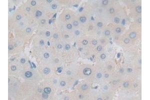 Immunohistochemistry (IHC) image for anti-Heat Shock Factor Protein 1 (HSF1) (AA 15-288) antibody (ABIN7431782)