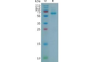 Mouse A Protein, His Tag on SDS-PAGE under reducing condition.