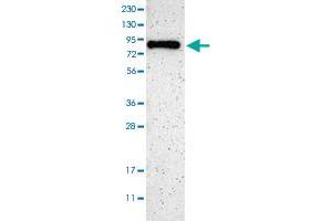 Western blot analysis of Human cell line RT-4 with SH3BP1 polyclonal antibody  at 1:100-1:250 dilution. (SH3BP1 Antikörper)