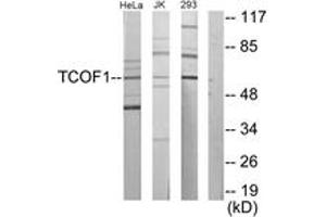 Western blot analysis of extracts from Jurkat/293/HeLa cells, using TCOF1 Antibody.