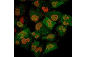 Immunofluorescence (IF) image for anti-Ubiquitin Carboxyl-terminal Esterase L1 (Ubiquitin Thiolesterase) (UCHL1) antibody (ABIN6940852)