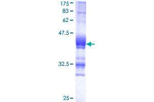 Image no. 1 for Glutamate-Ammonia Ligase (GLUL) (AA 274-373) protein (GST tag) (ABIN1355265)