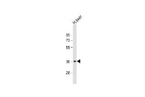 Anti-CTBS Antibody (N-Term) at 1:2000 dilution + human liver lysate Lysates/proteins at 20 μg per lane. (CTBS Antikörper  (AA 85-119))