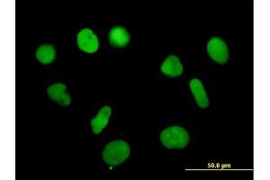 Immunofluorescence of purified MaxPab antibody to RPA3 on HeLa cell.
