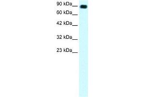 Human Daudi; WB Suggested Anti-C13ORF8 Antibody Titration: 1. (ZNF828 Antikörper  (Middle Region))