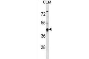 Western Blotting (WB) image for anti-Potassium Voltage-Gated Channel, Subfamily G, Member 2 (Kcng2) antibody (ABIN3000617) (Kcng2 Antikörper)