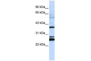FAM70A antibody used at 1 ug/ml to detect target protein. (FAM70A Antikörper  (N-Term))