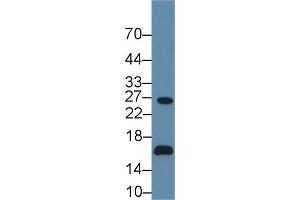 Detection of AQP2 in Human 293T cell lysate using Polyclonal Antibody to Aquaporin 2, Collecting Duct (AQP2) (AQP2 Antikörper  (AA 177-271))