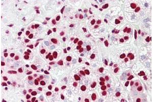 Anti-HnRNP K antibody IHC staining of human adrenal. (HNRNPK Antikörper  (AA 200-250))