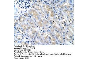 Rabbit Anti-Tsg101 Antibody  Paraffin Embedded Tissue: Mouse Kidney Cellular Data: Epithelial cells of renal tubule Antibody Concentration: 4.