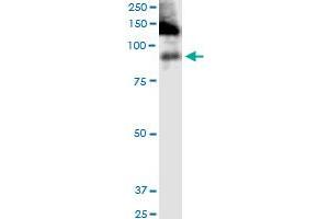 ITGB2 monoclonal antibody (M03), clone 3C7. (Integrin beta 2 Antikörper  (AA 1-769))