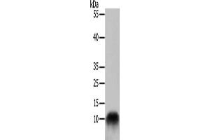 Gel: 10+15 % SDS-PAGE, Lysate: 50 μg, Lane: 293T cells, Primary antibody: ABIN7129018(COX7B Antibody) at dilution 1/700, Secondary antibody: Goat anti rabbit IgG at 1/8000 dilution, Exposure time: 30 seconds