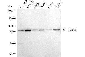 anti-RAS and EF Hand Domain Containing (RASEF) antibody
