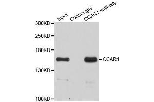 Immunoprecipitation analysis of 200ug extracts of HeLa cells using 3ug CCAR1 antibody. (CCAR1 Antikörper  (AA 1-200))