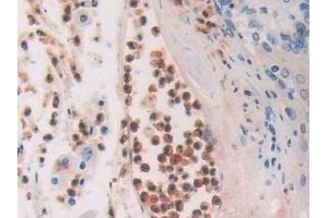 Immunohistochemistry (IHC) image for anti-Cytidine Deaminase (CDA) (AA 2-146) antibody (ABIN7440833)