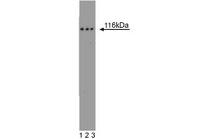 Western blot analysis of FAK on a A431 cell lysate (Human epithelial carcinoma, ATCC CRL-1555). (FAK Antikörper  (AA 354-533))