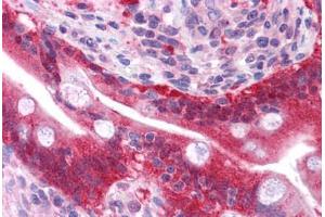 Human Small Intestine: Formalin-Fixed, Paraffin-Embedded (FFPE) (Galectin 3 Antikörper  (AA 38-87))