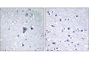 Immunohistochemistry analysis of paraffin-embedded human brain tissue, using GRM1 Antibody.